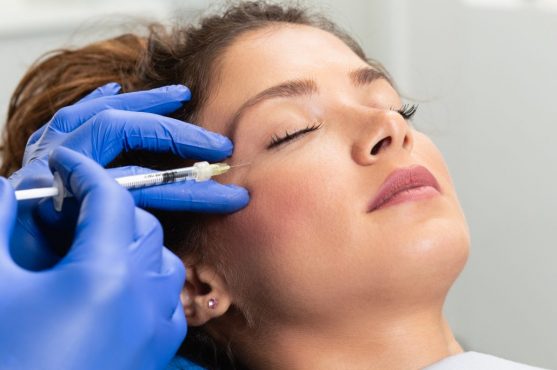 Sanfte Faltenglättung mit Hyaluronsäure Faltenglättung mit Hyaluronsäure
